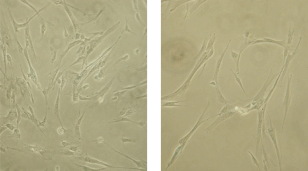 Cellule WI-38, By Yuanyuan Li, Trygve O. Tollefsbol - Yuanyuan Li, Trygve O. Tollefsbol. "p16INK4a Suppression by Glucose Restriction Contributes to Human Cellular Lifespan Extension through SIRT1-Mediated Epigenetic and Genetic Mechanisms." PLoS One, 2011 url:[1]This image is cut from Figure 4 in the articleCopyright license of PLOS ONE, CC BY 4.0, https://commons.wikimedia.org/w/index.php?curid=61520732